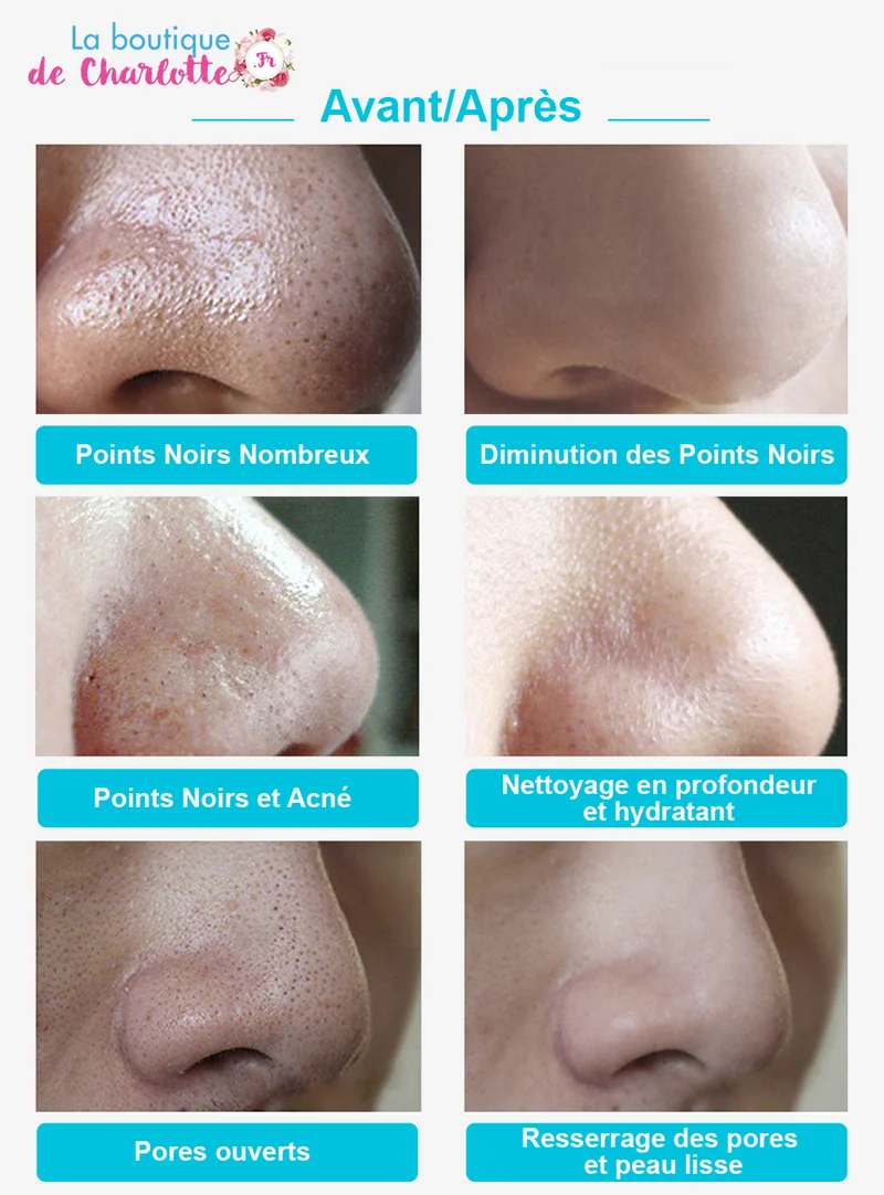 BANDES DE NETTOYAGE ALOE VERA POUR VISAGE