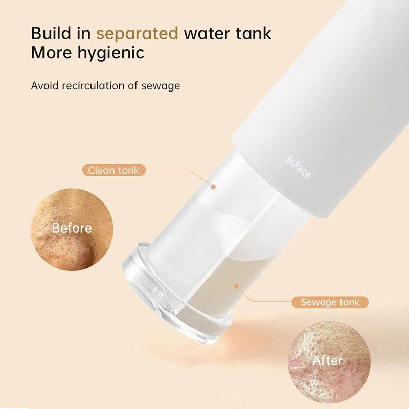 Xiaomi inFace Thermal Aqua Peel Facial Device Electric Acne Cleaning Blackhead Remover Black Point Cleaner Home Use Face Cleansing Tools