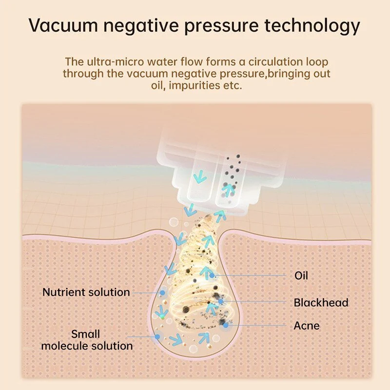 Xiaomi inFace Thermal Aqua Peel Facial Device Electric Acne Cleaning Blackhead Remover Black Point Cleaner Home Use Face Cleansing Tools